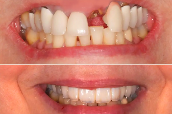 Venkateswara Dental Hospital