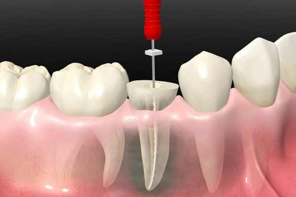 Venkateswara Dental Hospital
