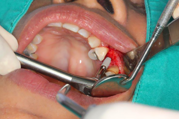Venkateswara Dental Hospital