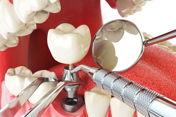 Venkateswara Dental Hospital